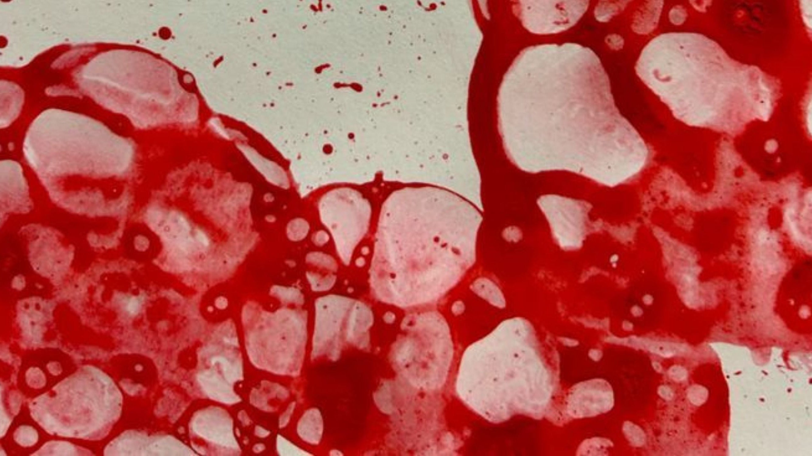 Laundry 101: Removing Blood Stains