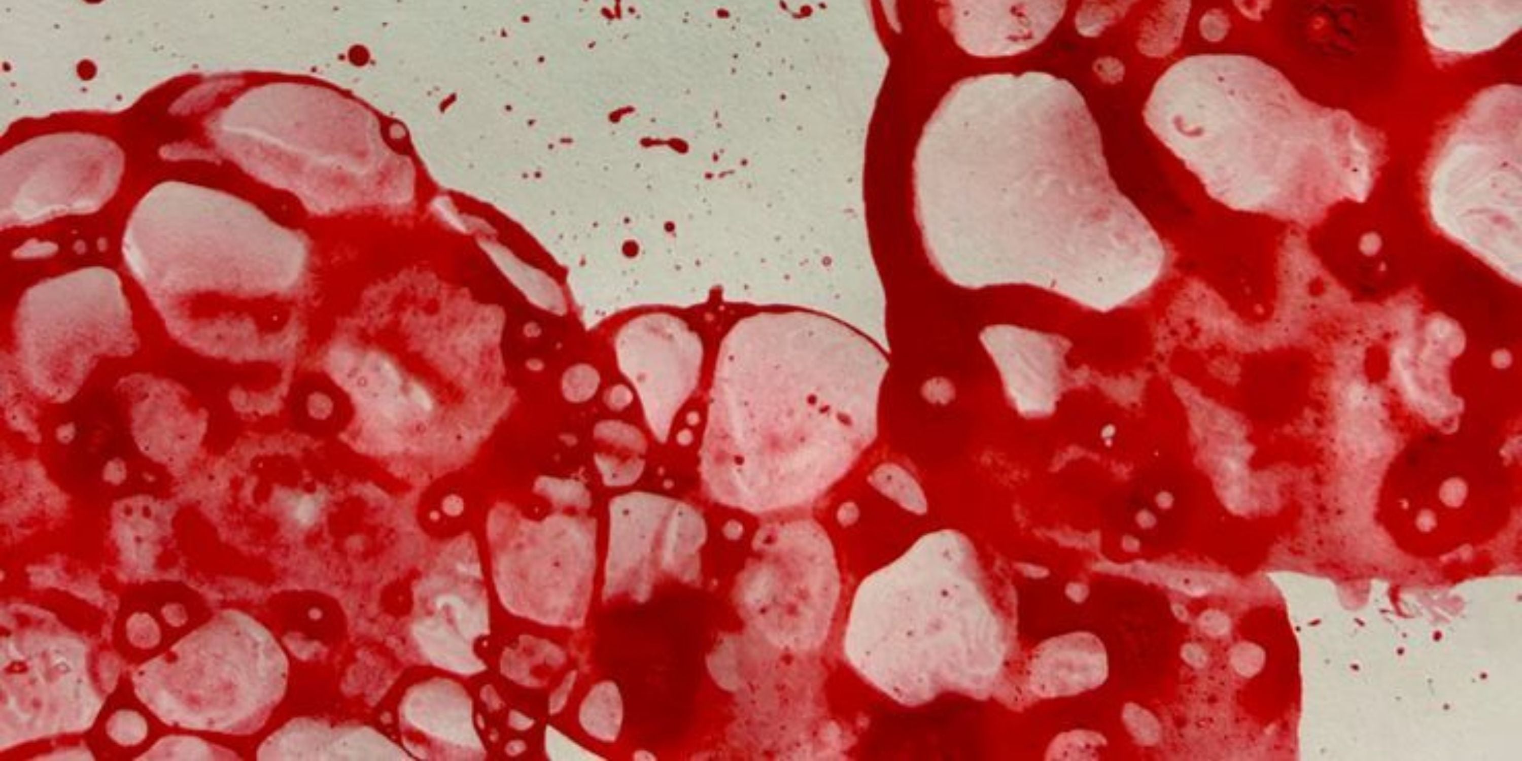 Laundry 101: Removing Blood Stains